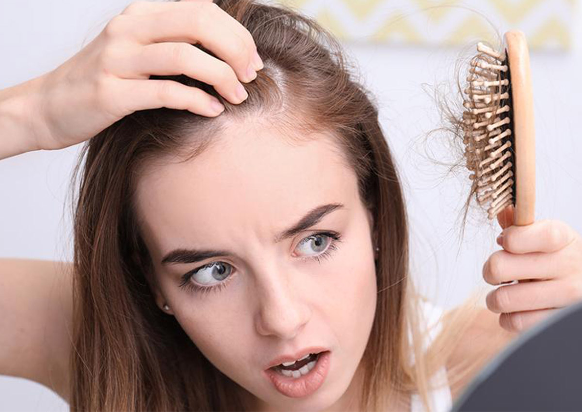 علاج قشره الشعر بسرعه