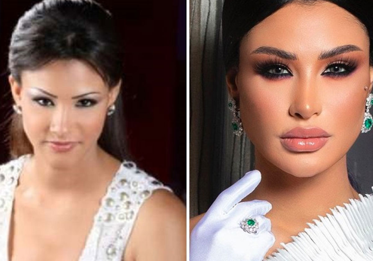 اميمة طالب والفارق الكبير خلال السنوات