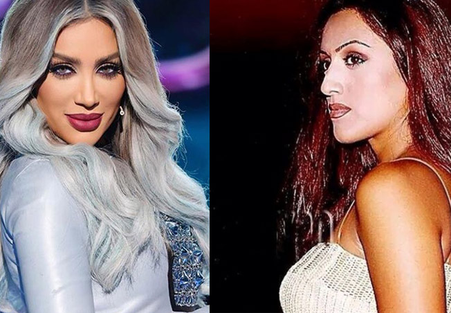 نجمات تغيرن كثيراً بعد نفخ الخدود... الصور ستصدمك