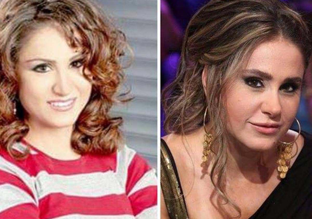 ديمة قندلفت قبل التجميل وبعده