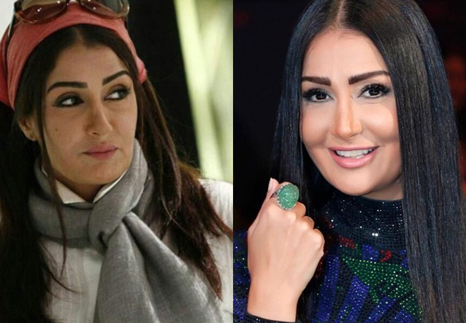 غادة عبد الرازق قبل بعد عملية تجميل الأنف