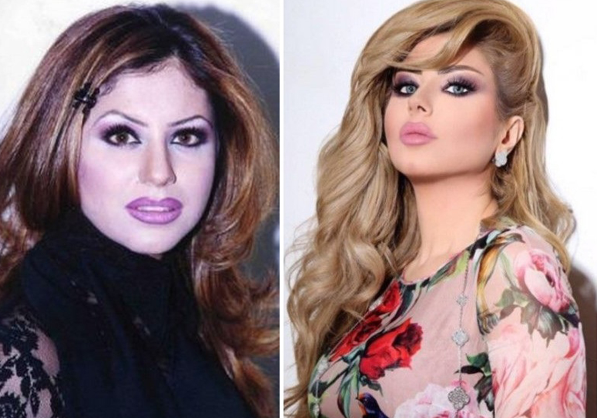 حليمة بولند قبل عمليات التجميل وبعدها