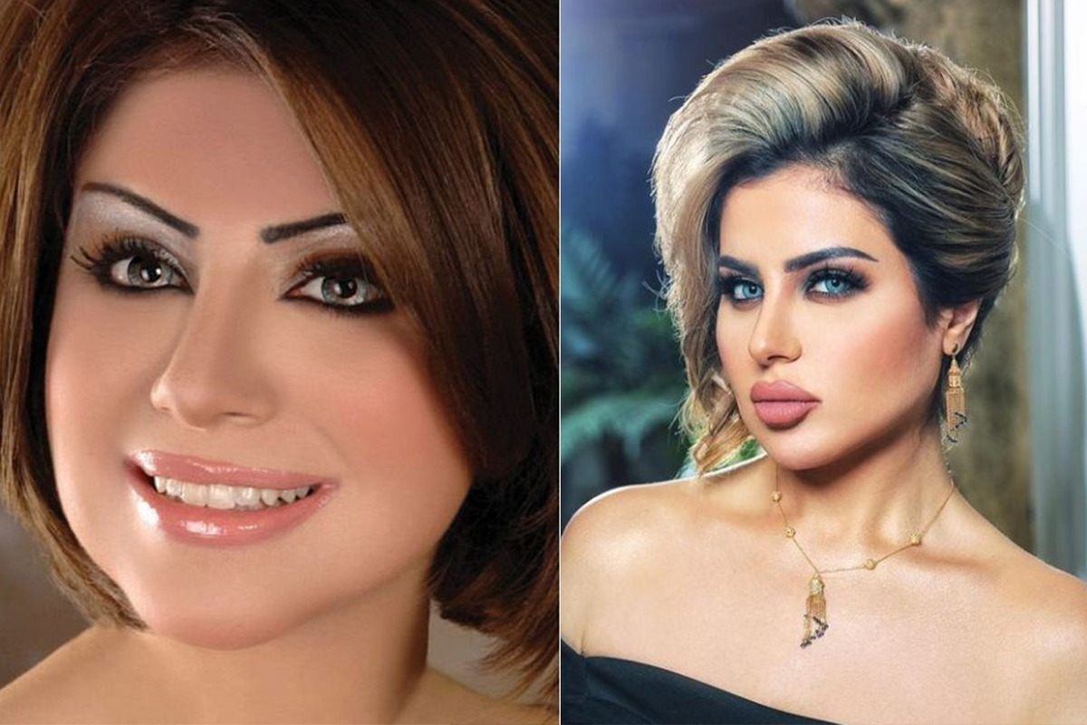  نجمات الخليج قبل فيلر الشفاه وبعده: صور تظهر الفرق المذهل