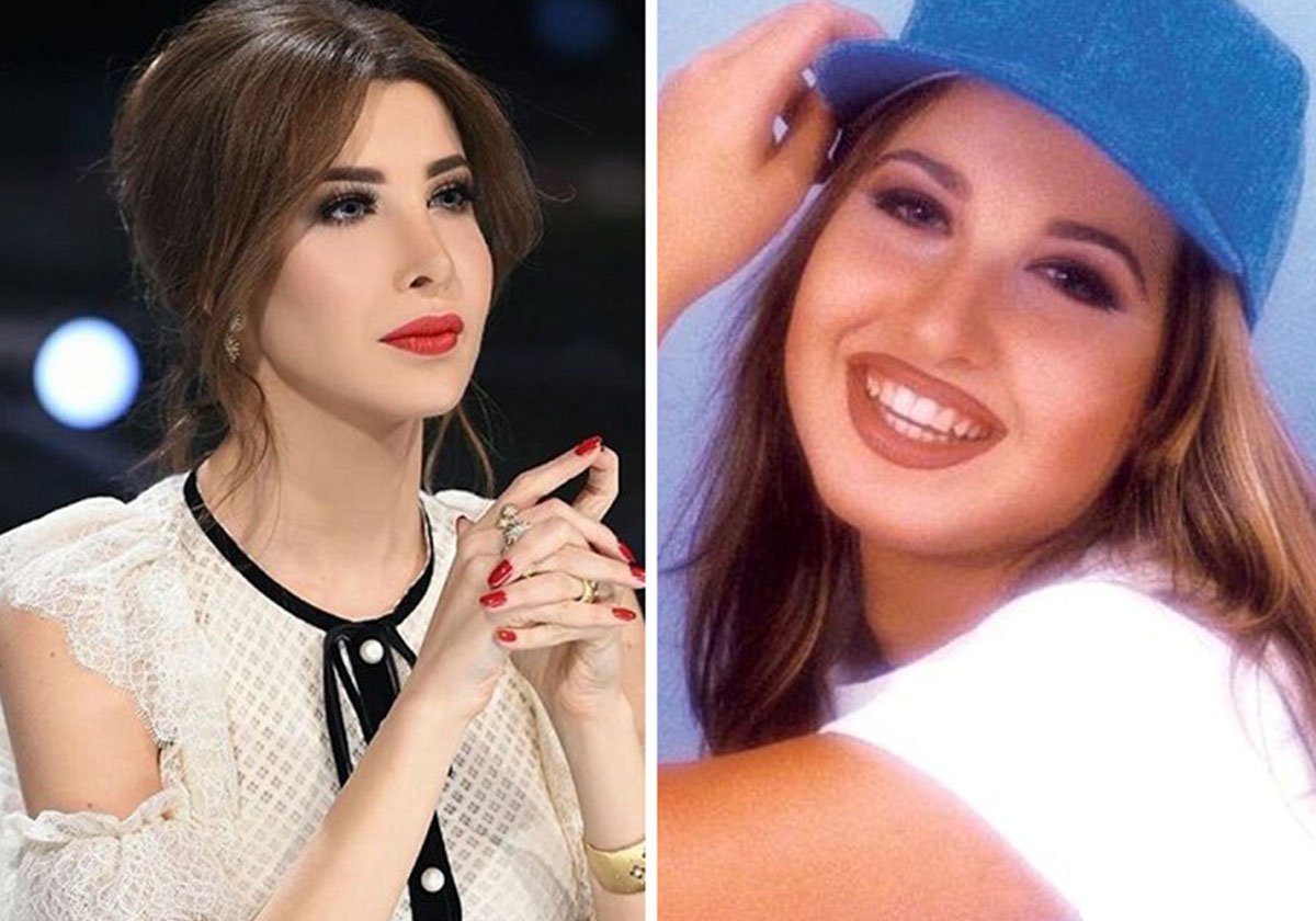 عمليات تجميل كانت ضرورية للنجمات...والصور تؤكد ذلك!