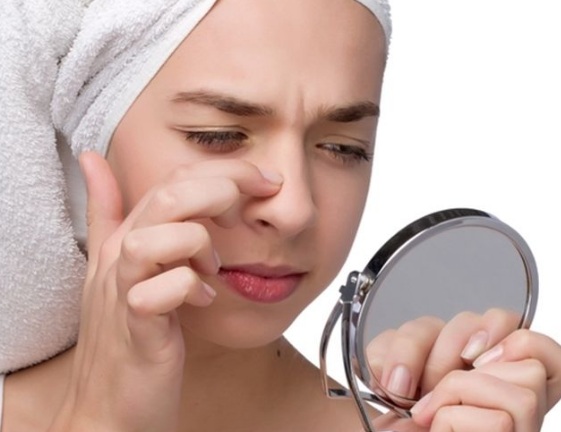 طرق ازاله الرؤوس السوداء