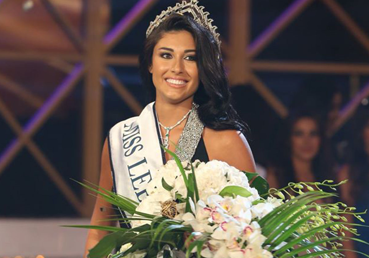 لن تصدّقي كيف أصبحت ملكة جمال لبنان 2013 كارين غراوي بعد عمليّات التجميل! 
