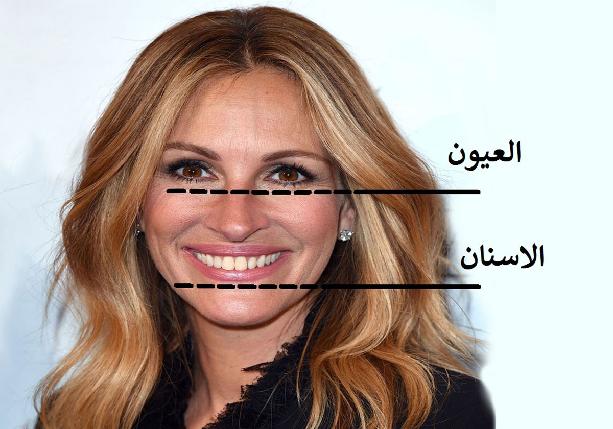 هذه هي معايير الابتسامة المثالية! فهل تمتلكينها؟