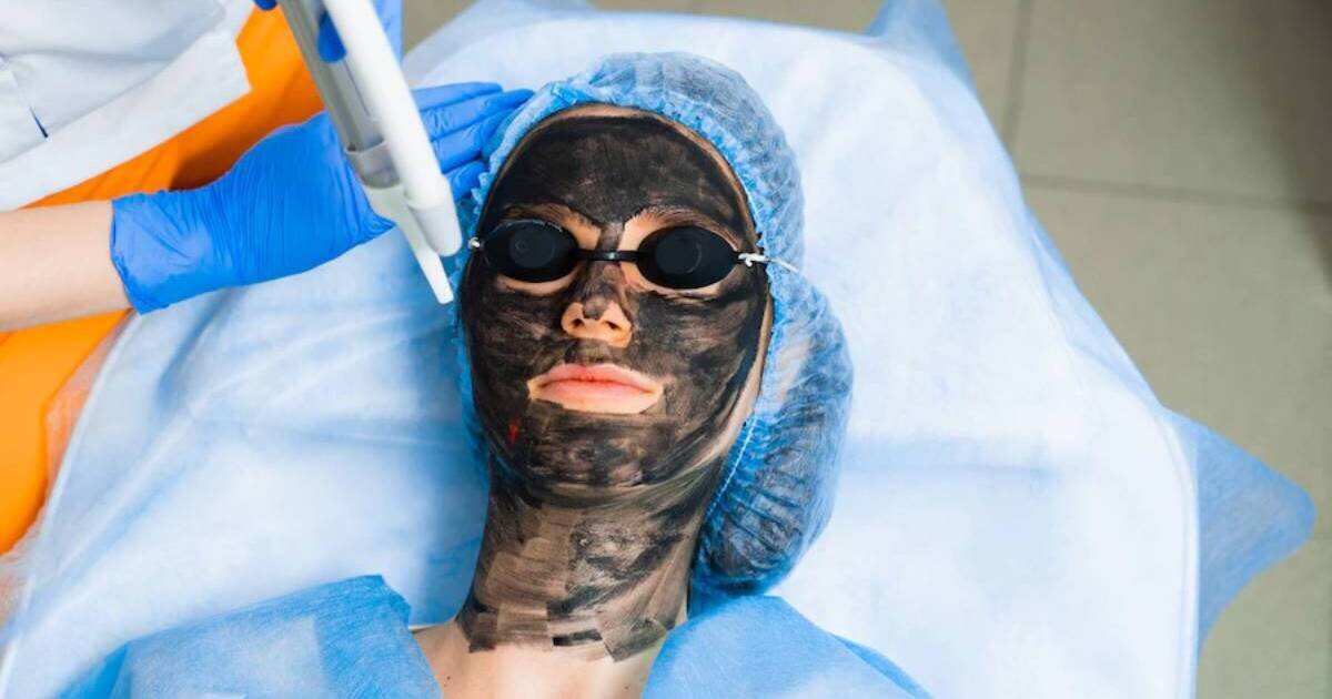 الليزر الكربوني قبل وبعد