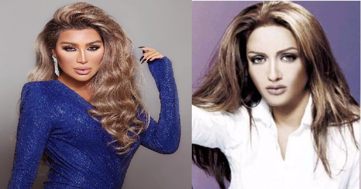 مايا دياب قبل وبعد الفيلر