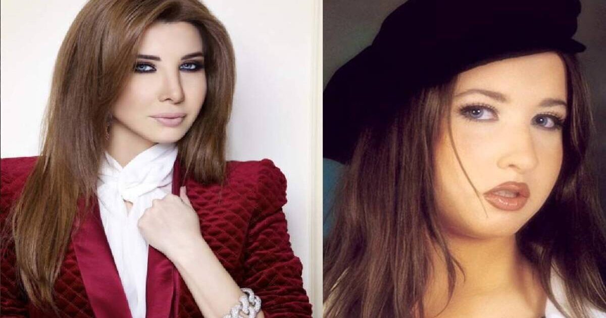 نانسي عجرم قبل وبعد فيلر الوجه