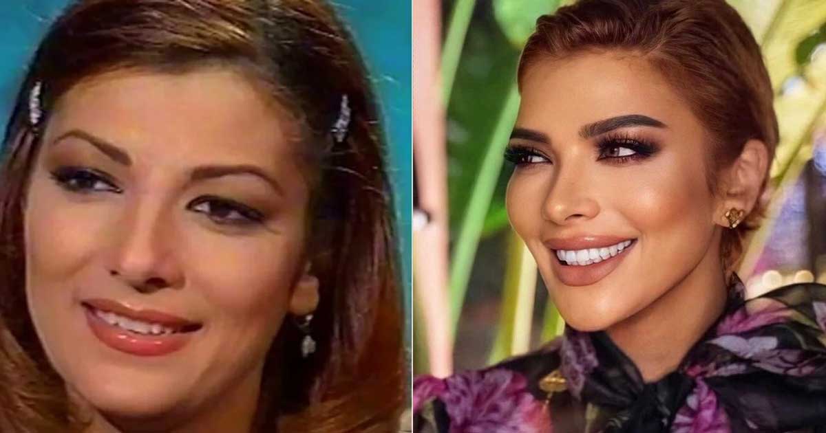 النجمات قبل وبعد الهوليوود سمايل