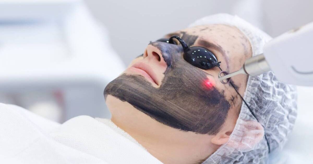 الليزر الكربوني للتصبغات