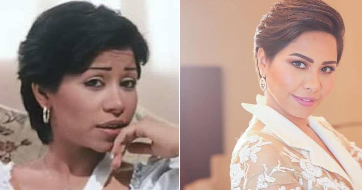 عمليات تجميل ناجحة