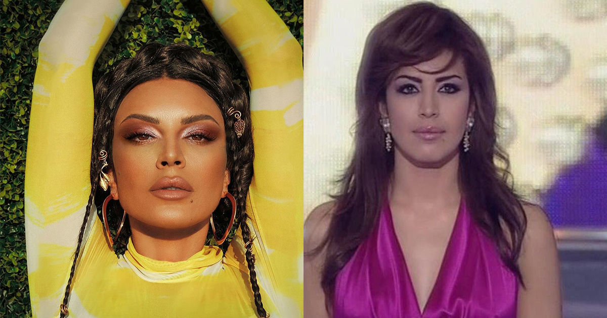 النجمات قبل عمليات التجميل