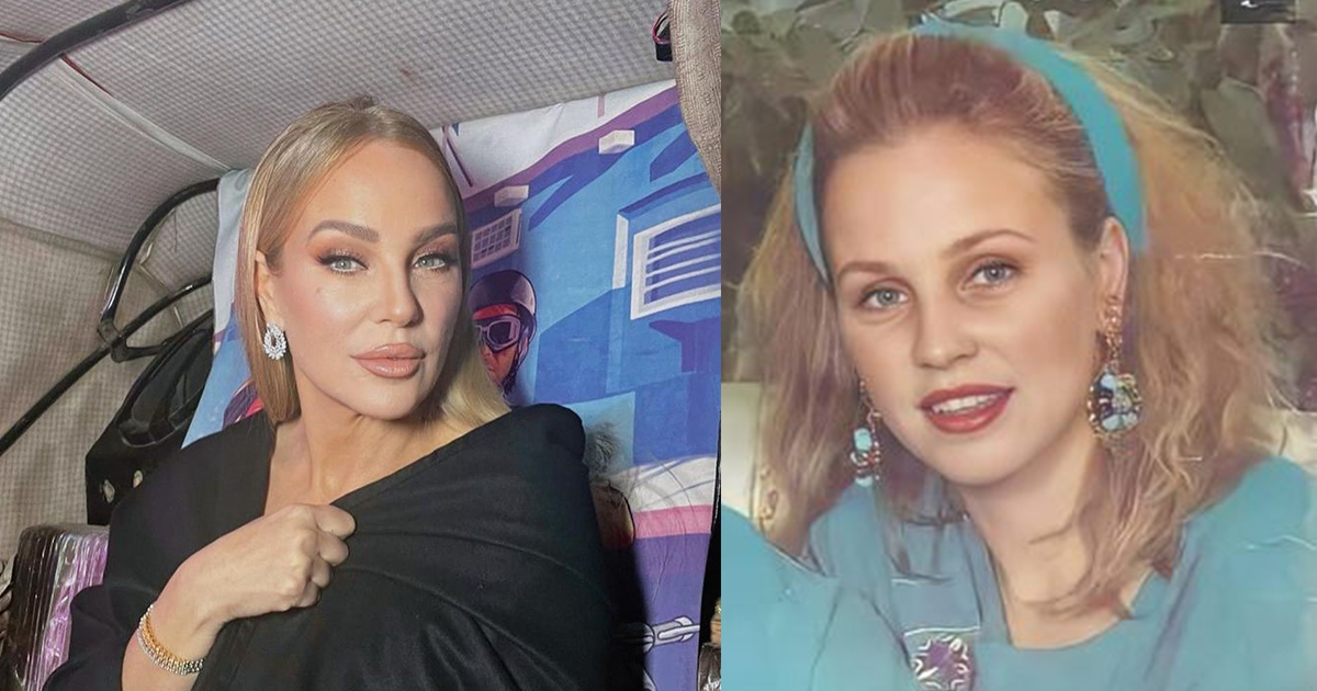 النجمات قبل عمليات التجميل