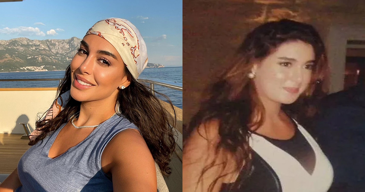 النجمات قبل عمليات التجميل