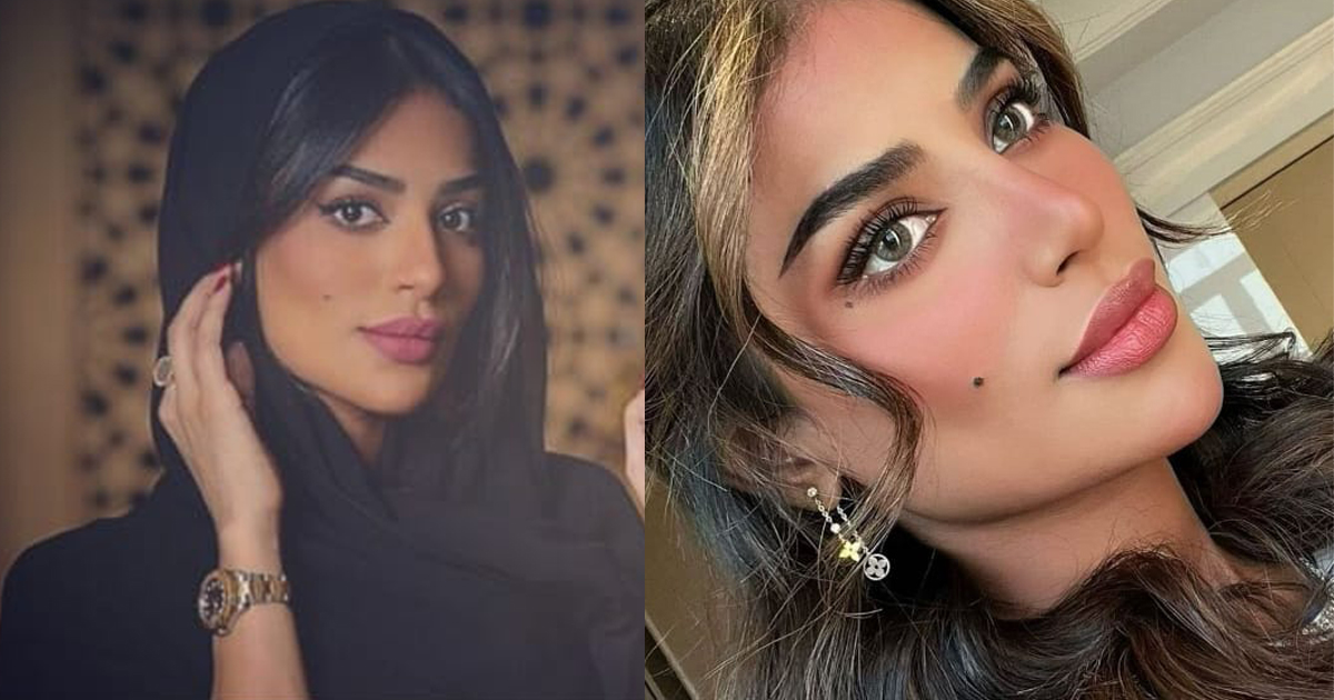 بلوغرز سعوديات خضعن لتذويب الفيلر وأصبحن أجمل بكثير