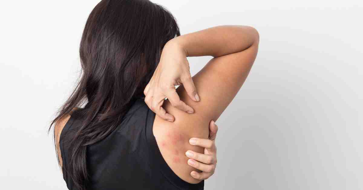 حكة في الجسم بدون طفح