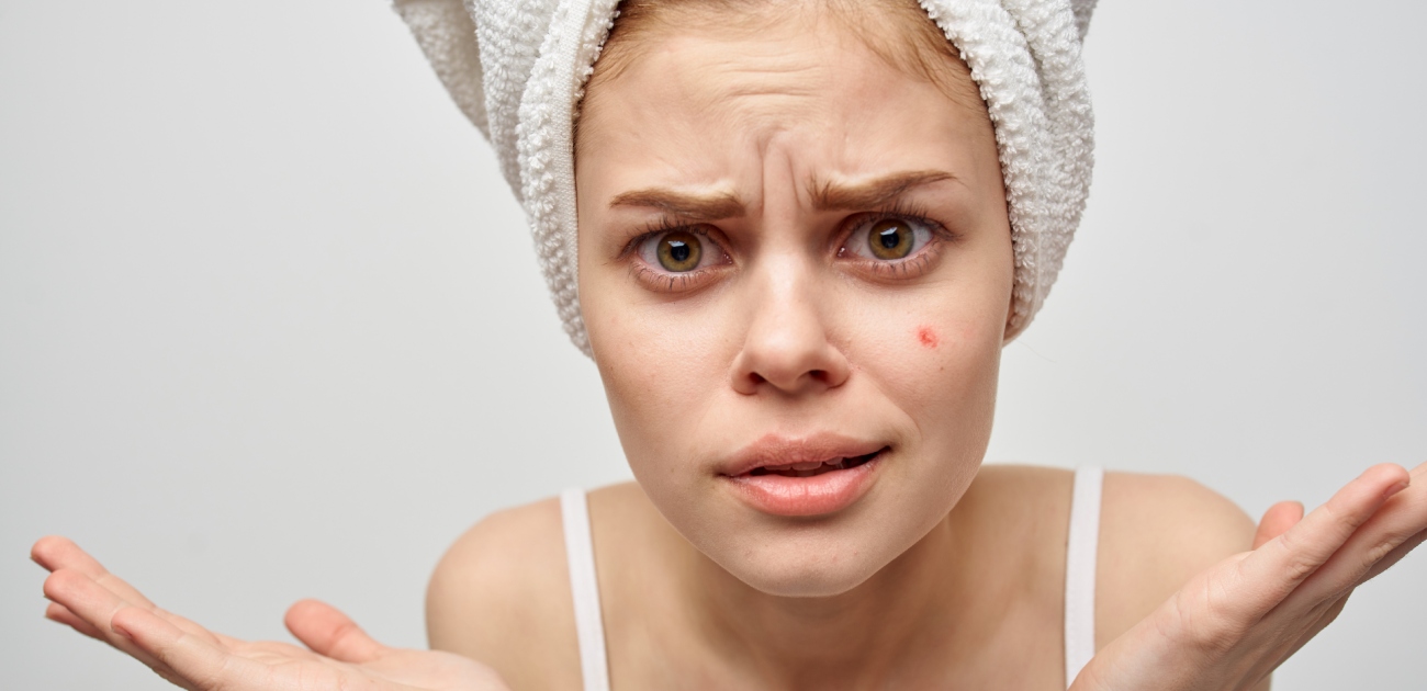 البثور مشكلة شائعة وعليك التخلص منها من خلال اعتماد روتين عناية مناسب!