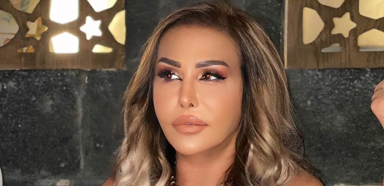 مها المصري بعد التجميل وأهم التغيرات التي أجرتها