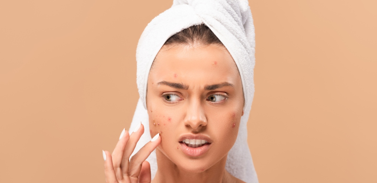 حساسية الوجه​: ما أنواعها أسبابها وأعراضها؟